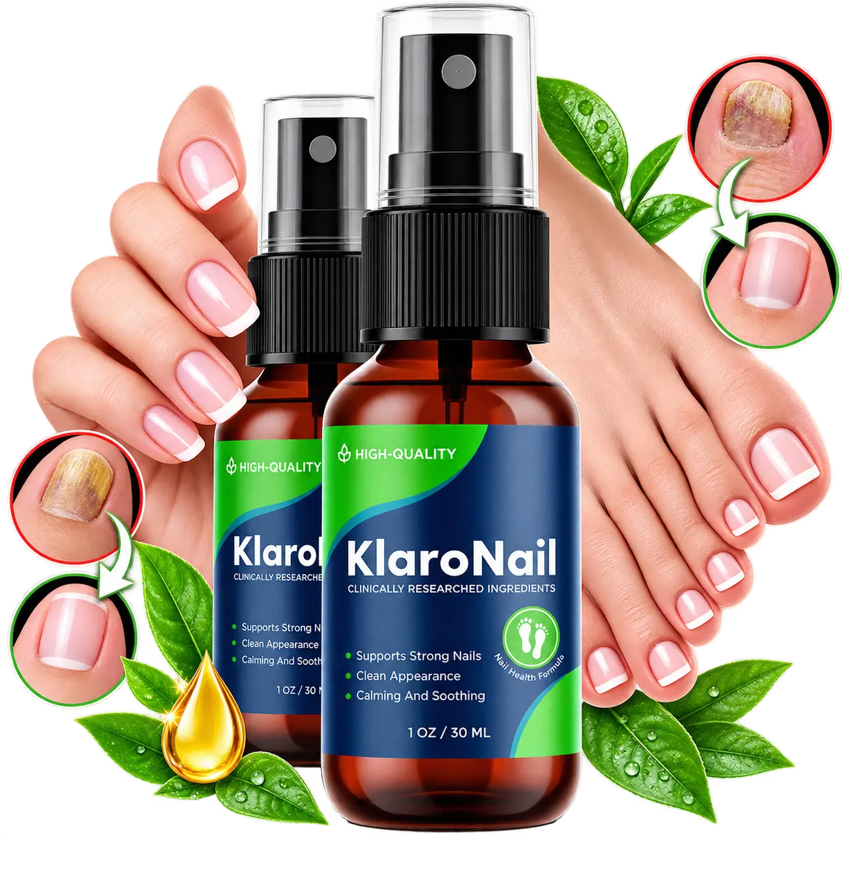 KlaroNail Product Bottle
